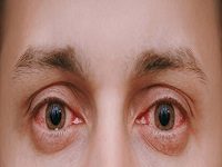 PRAYERS FOR EYE HEALING